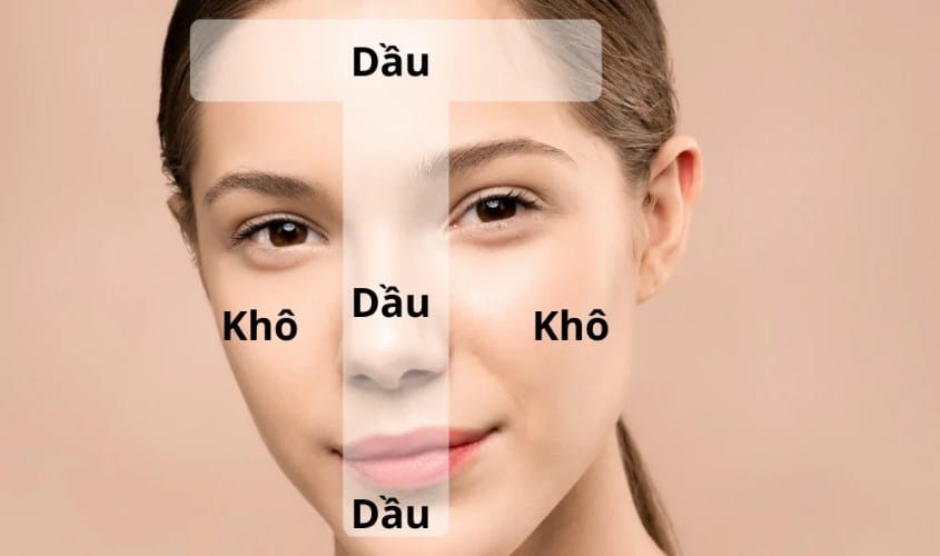 Da hỗn hợp là gì? Quy trình skincare cho da hỗn hợp hiệu quả